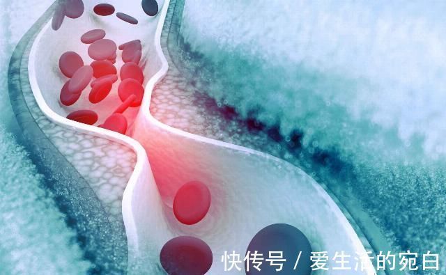 脾肾阳虚|中药刺五加有哪些功效,宁得一把五加,不用金玉满车