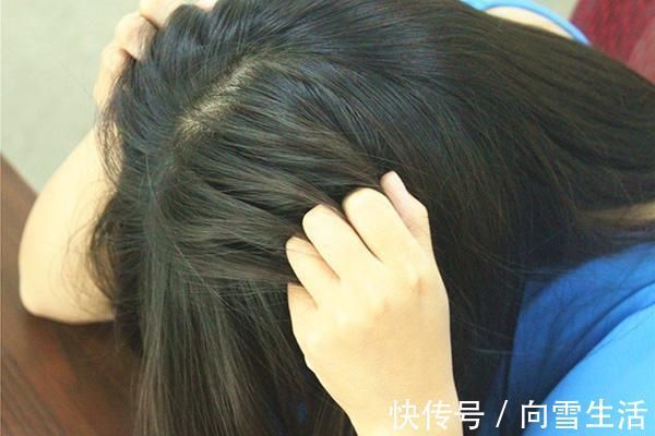 雌激素|女性身体中雌激素低，会有哪些变化？如果一个都不占，女人味十足