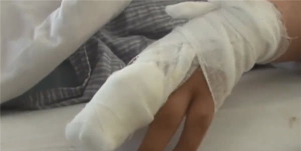 小姑娘|9岁女孩儿手指“出血”,奶奶匆忙用偏方,医生都心疼孩子