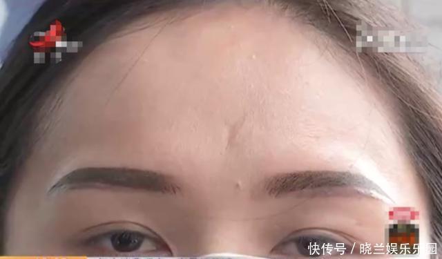 女子去纹眉花3900元,脸上却出现4条眉毛?女子:被坑惨了