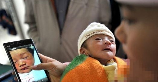 医生|宝宝出生25天就像个小老头,医生的一席话,让父母恨自己也太不上心了