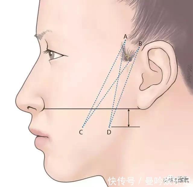 半个娱乐圈女明星脸上都有的这个坑,真的是线雕的锅吗?