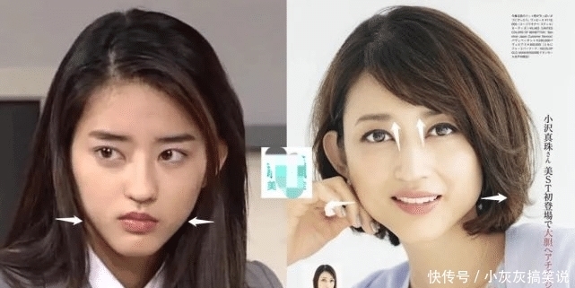 优越鼻型精细化到山根的宽窄?对颜值影响还真大