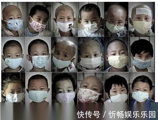 甲醛|18岁大二男孩高烧不退，查出白血病后，大骂舍友都是你害的