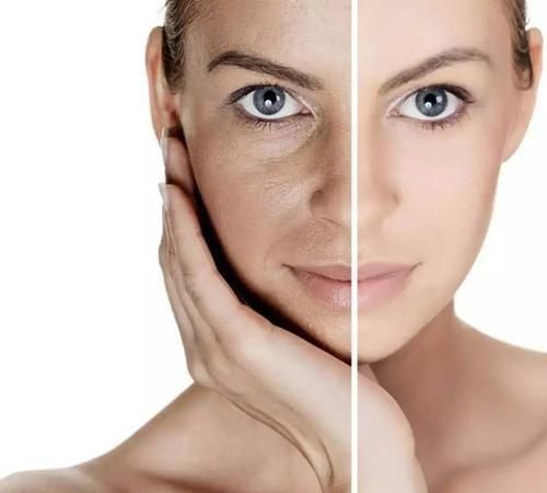 面色暗淡或面色发黄,没准是身体发出的警报!