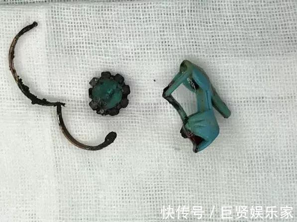 项链|5岁女儿暴瘦,医生检查后让娃“摘下项链”,妈妈懵了她没戴啊