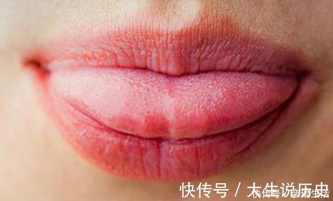 舌头|舌头出现4大“异常”，多半是疾病已找上门，为健康了解