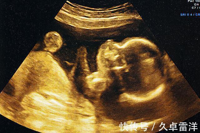 孩子|每次产检结果正常,孩子生出后发现畸形,医院需要负责吗