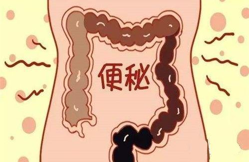 香蕉|便秘期间，吃什么能“润润”肠道？5个选择试一下