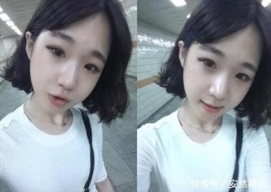 疼痛|小脸确实更可爱,看完整容过程,只觉得满屏的疼痛