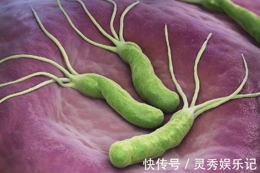 幽门螺杆菌|肠胃“修复器”找到了,不是牛奶,若你爱喝,胃一天要比一天舒服
