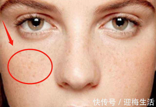 子宫|子宫好不好,看脸就知道脸若有4个不良现象,要注意保养子宫