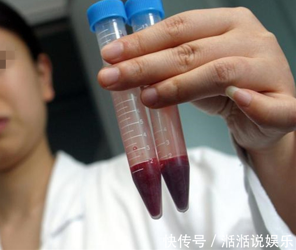 医生|新生双胞胎“2个爹”,医生鉴定后妻子道出原因,令人唏嘘