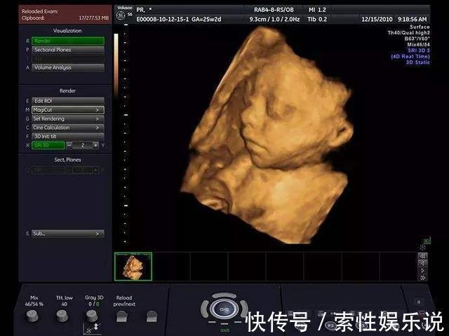 子宫|胎儿在子宫内，怎么吃喝拉撒睡6个有趣的胎儿小知识，涨见识！