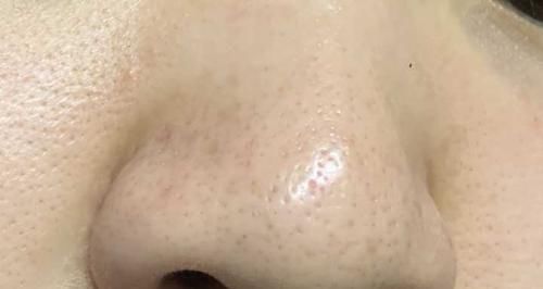 希望自己|鼻子越来越塌,都是因为这3个小动作,再不改变颜值会越来越低