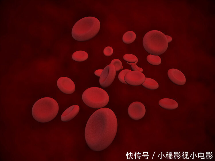 医院|身上无缘无故有淤青,很可能是肝不好!医生提醒:快去医院检查