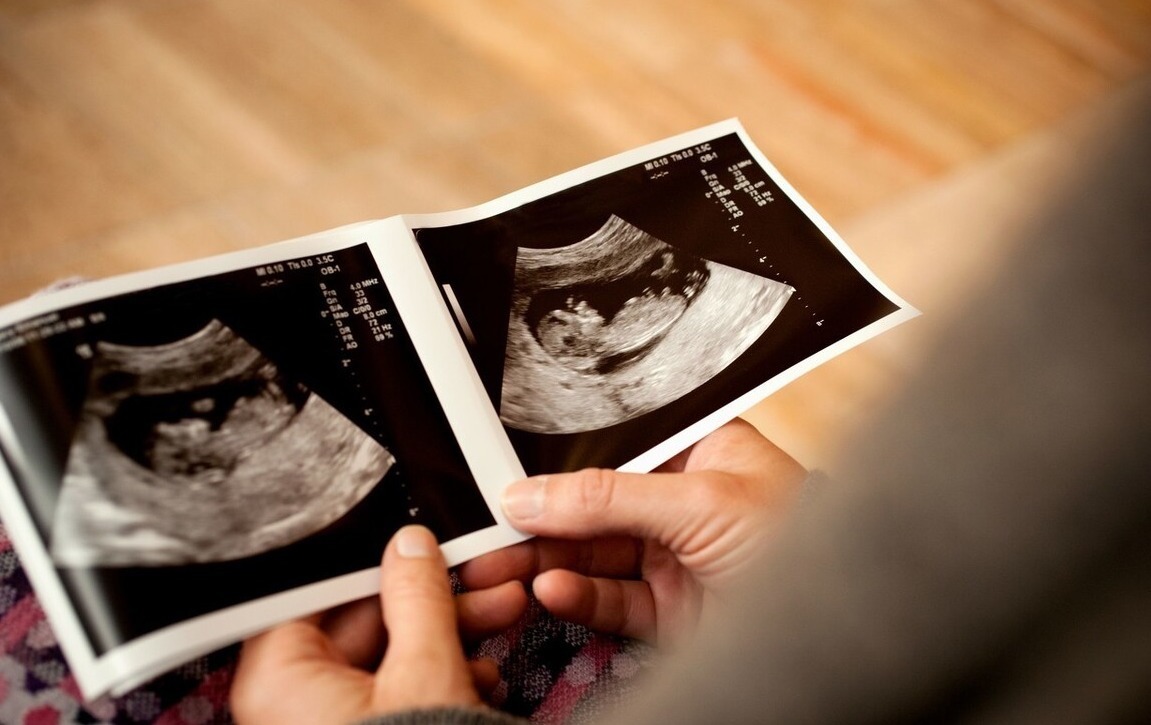 囊肿|身体有4个变化,八成是宫颈有囊肿,做好3件事,囊肿会消失