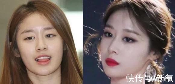 眼距&很多人都混淆了眯眯眼和小眼睛的区别