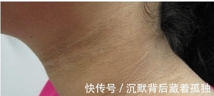 脖子|9岁小女孩脖颈发黑洗不掉,经医院检查后,医生的话却让家长笑了