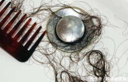 头发|你还在“散头发”睡觉？多数女生做错了，小心变成“秃头女孩”