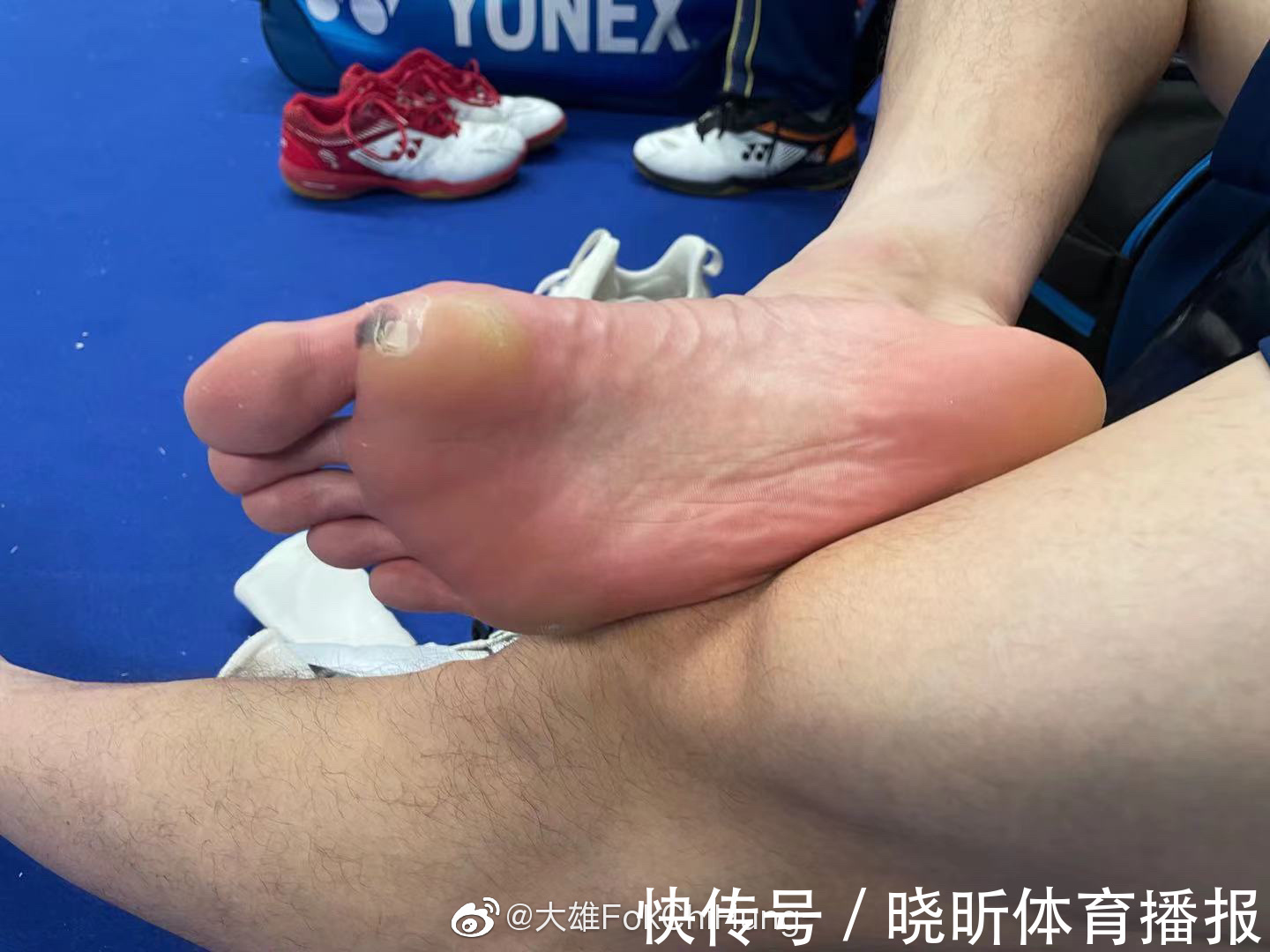 退赛|石宇奇解释为何赛点退赛！首局丢得太可惜，身体哪都疼早想弃权