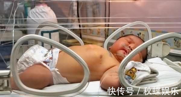 产妇|41岁高龄产妇竟产下17斤巨婴, 巨宝宝胃口更是大得让人咂舌