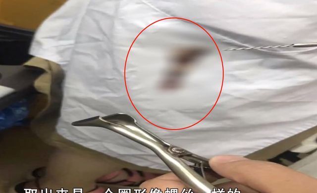 孩子|3岁女童身体散发异味,妈妈带去医院一查当场作呕,请一定小心