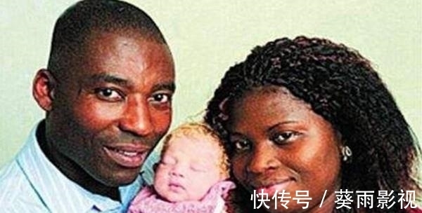 小孩|为什么黑人父母会生出纯白宝宝,不明基因突变