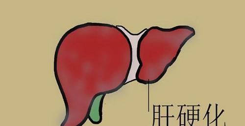肝脏变硬,身体有4征兆,肝胆科医生:牢记2点,清理肝毒