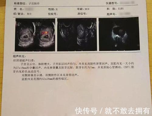 白马王子|同样是生孩子,一个20多岁一个30多岁,到底哪个年龄段更好