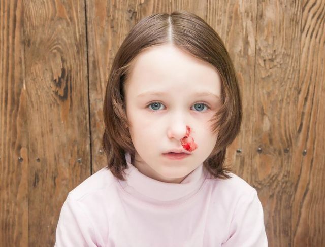 孩子|5岁男孩鼻子流血，爸爸“三个果断”救了孩子，医生：值得借鉴