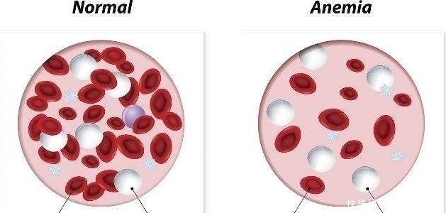 前列腺|男性有3种“表现”,是前列腺正在发生“病变”,早知早受益