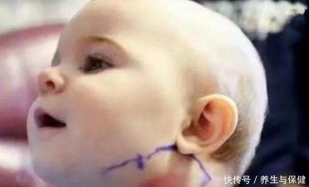 羽毛|宝宝脖子突然长羽毛,家人认为是天使,医生怒斥怎么当妈的!