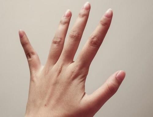 葡萄糖|血糖高不高,看双手就懂?若有这4种症状,或在暗示血糖偏高了