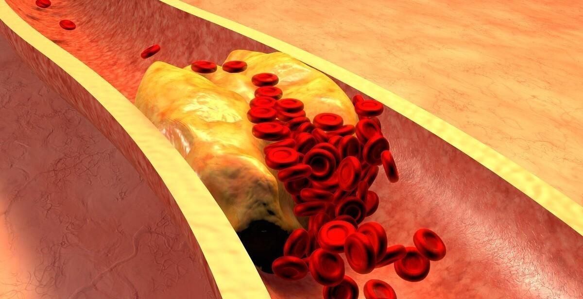 86岁老人甘油三酯12,血管干净无淤,“诀窍”在于常吃这3物