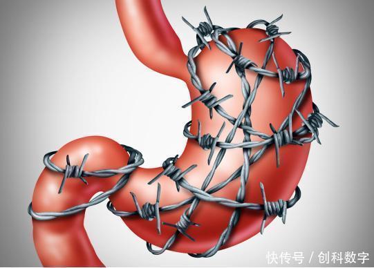 幽门螺杆菌最怕1物,不是大蒜和西兰花,你若常吃,胃会变好