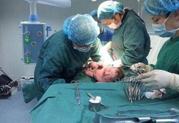 麻药|头胎剖腹产,第二胎继续剖,到底有多痛这些有经验的宝妈这样说