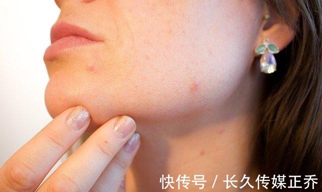 色素|46岁广东女子色素沉淀多,坚持2个习惯,帮助嫩白,或可了解