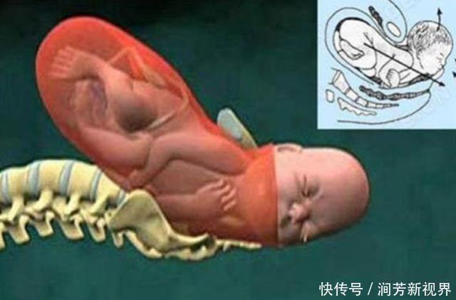 骨盆|顺产分娩时,宝宝咋从产道中爬出来的带你看清全过程,真心不易
