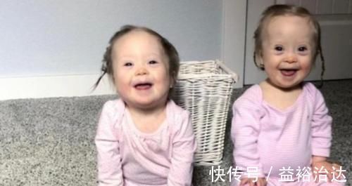 胎儿|四维彩超是什么?四位彩超可以看出胎儿是唐氏儿吗?