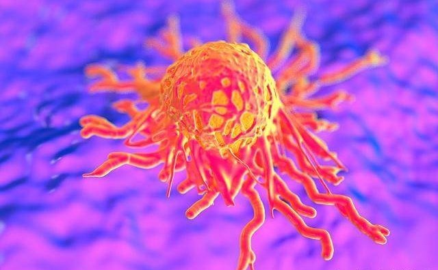 “癌症”不是那么容易有的，患“癌”的2大原因，早知道早预防