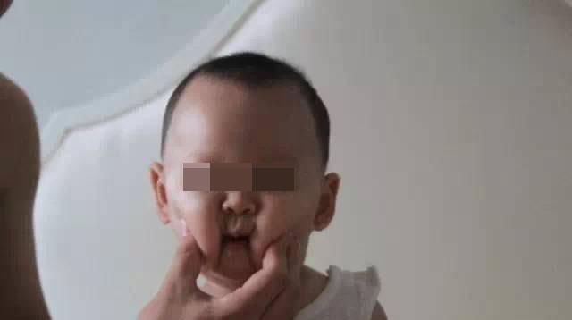 膀胱经|儿科医生经常抚摸宝宝身上这4个部位,既增强智力,又利于健康