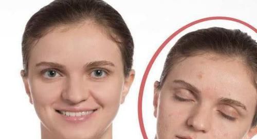 女人有没有妇科病，这3个“地方”一看便知，00后也别害羞