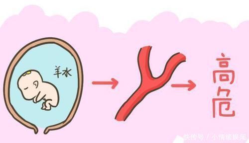 秘密|怀孕期间最怕羊水偏多、偏少还有浑浊，羊水的这些秘密你都知道吗