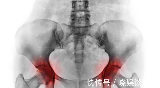 分泌物|女性白带出现这三大危险信号，应当要提防几种妇科疾病