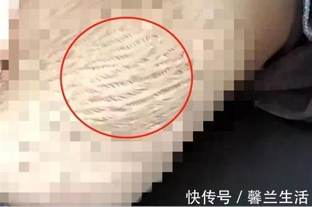 宝妈|23岁女孩已经有四个孩子,腹部照片看着心酸,引发众多宝妈共鸣