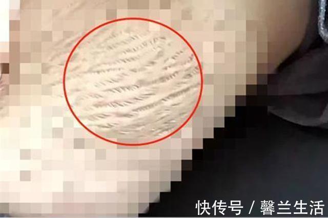 宝妈|23岁女孩已经有四个孩子，腹部照片看着心酸，引发众多宝妈共鸣