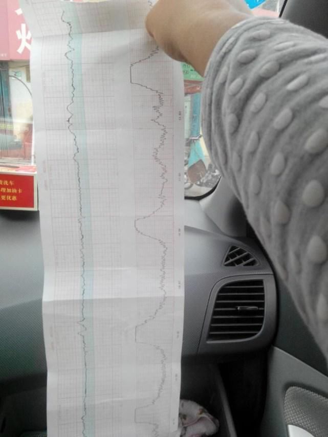 暖心|准妈妈临产前宫缩痛,丈夫暖心举动让网友称赞,这辈子嫁对人了!