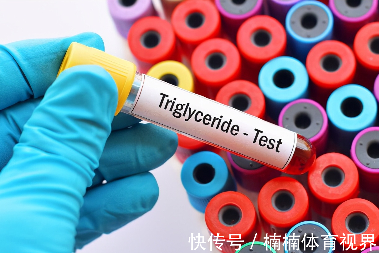 运动|年过50岁,还能跑步锻炼吗?注意做好4个方面,有益健康更安全