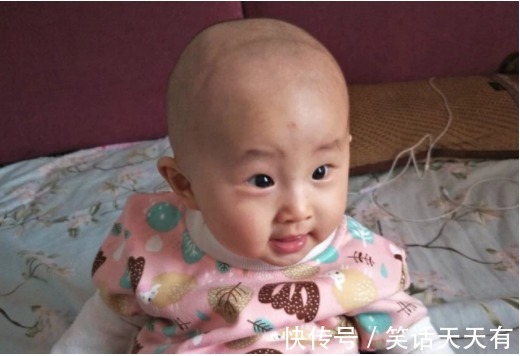 佝偻病|宝宝囟门又被称为“命门”,出现这三种现象时,要去医院
